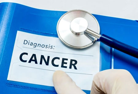 The Impact of Deep Learning to Diagnose Cancer